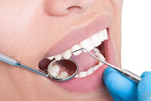 Closeup of healthy smile