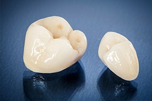 Dental crown restoration