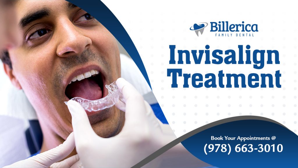 Invisalign treatment